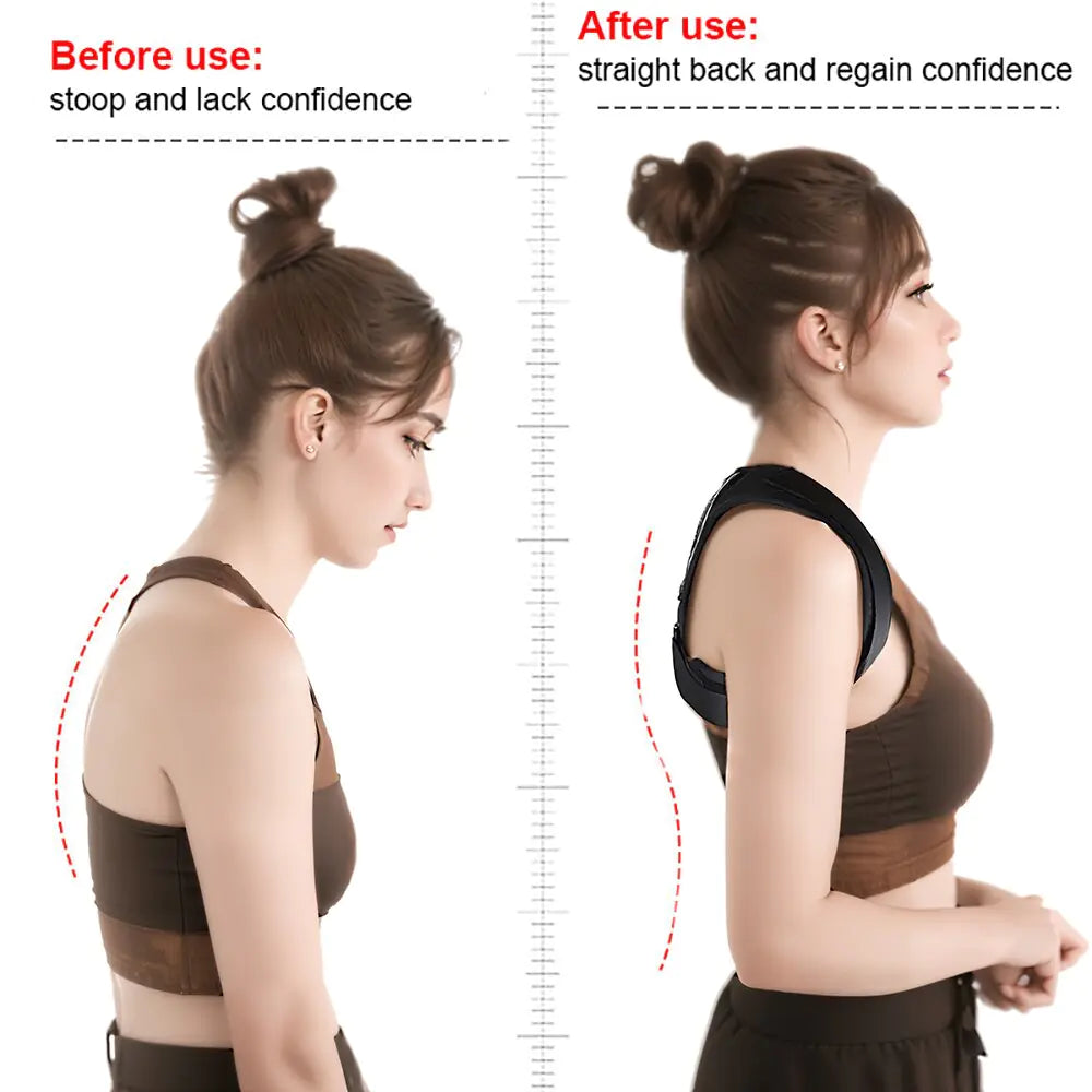 Posture Corrector